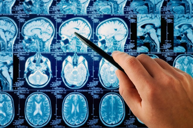 can-cell-phones-cause-brain-cancer-we-asked-the-experts-640x0